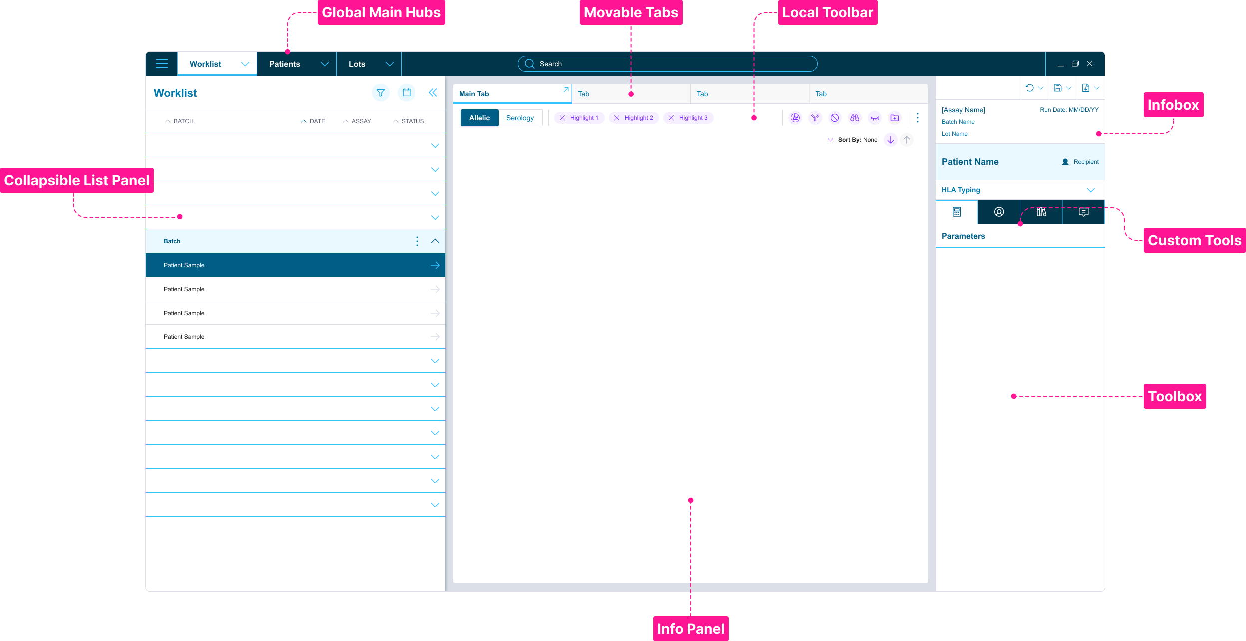 MatchX full layout — annotated